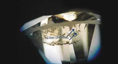 Diamond lasering treatment example one